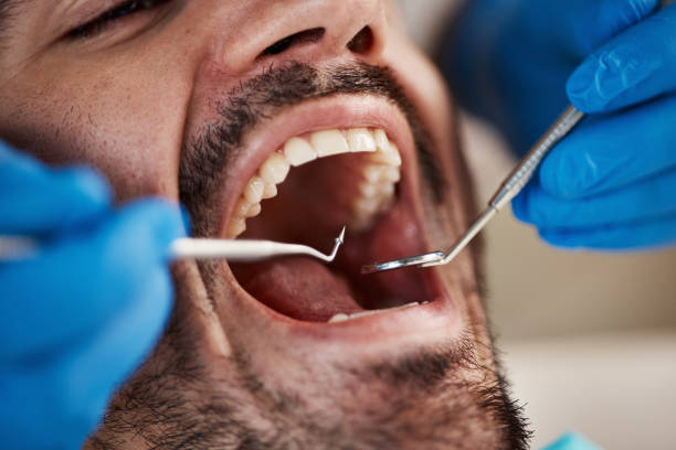 Best Tooth Extraction  in Harvey, MI